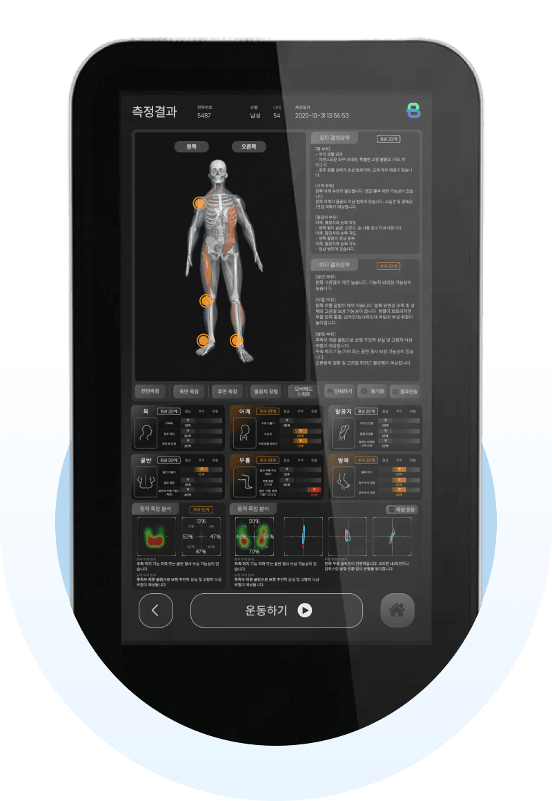 분석 기반 맞춤 운동